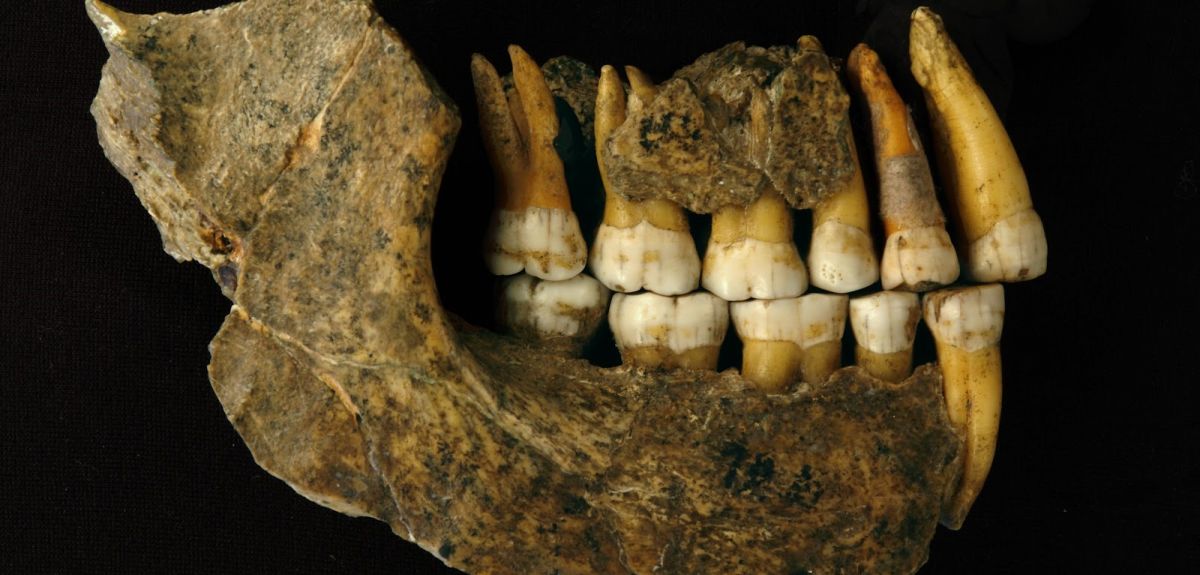 Maxilla and mandible assemblage of a late Neanderthal from Spy cave  Illustration by Patrick Semal © RBINS (co-author on this paper)   