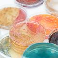 Piles of petri dishes with bacterial colonies growing on culture media. 