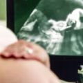 Pregnant woman getting ultrasound