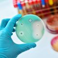 A hand wearing a blue latex glove holds up a petri dish which has colonies of bacteria growing on it. Clear circles can be seen on the plate where an antibiotic has prevented the bacteria from growing. In the background is a stack of petri dishes 